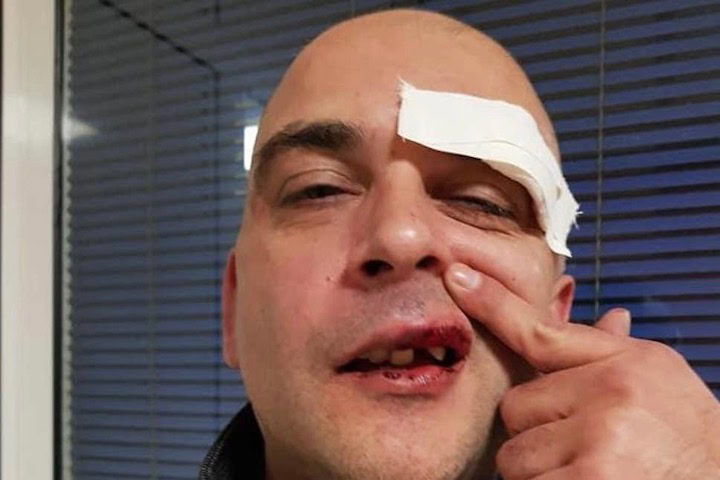 Serbian man bashed in homophobic incident forgives attackers