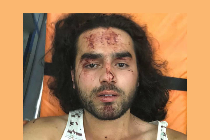 Police Ordered To Reinvestigate Attack On Gay Activists