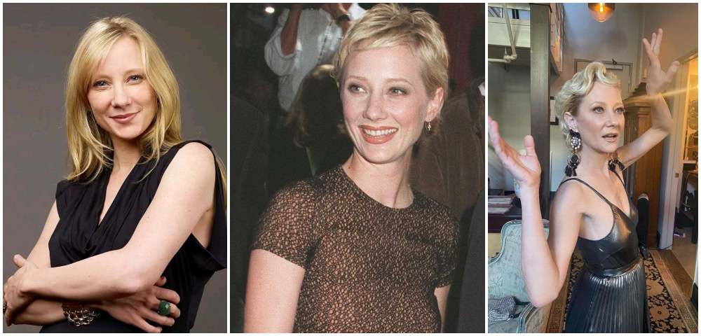 Actor Anne Heche Passes Away a Week After Car Crash