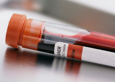 Blood hiv hep c disease test worker charged tissue
