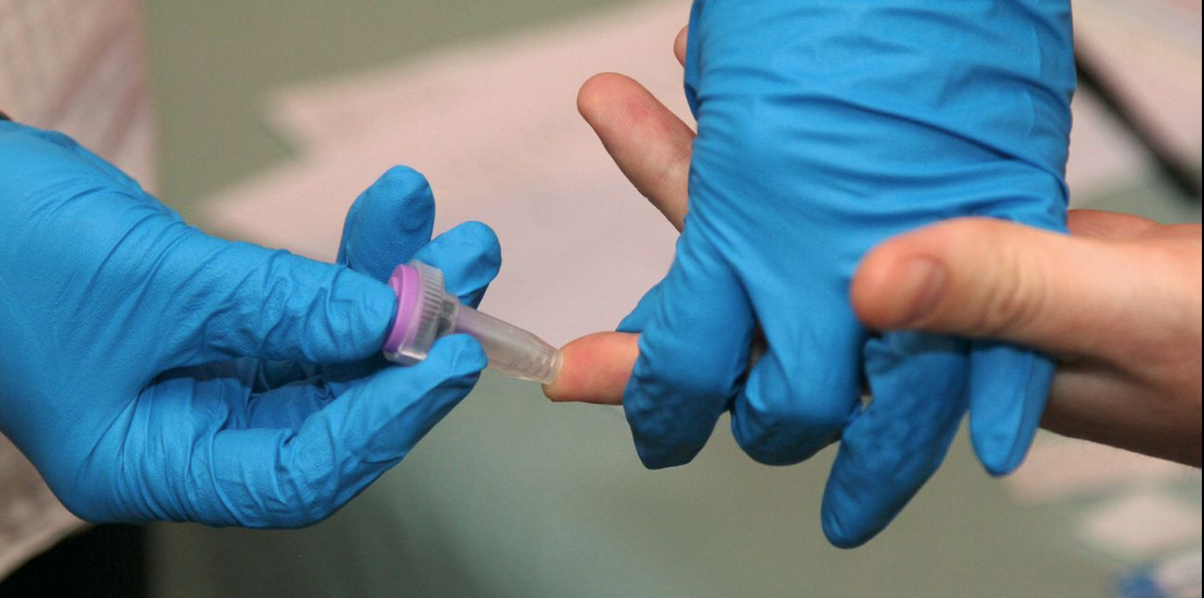 Rapid HIV testing to start in South Australia