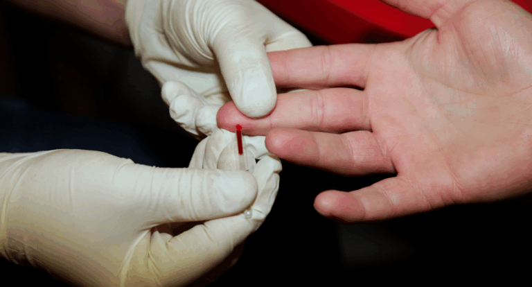 rapid testing HIV blood medical health test
