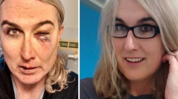 Stephanie McCarthy assault attack before and after