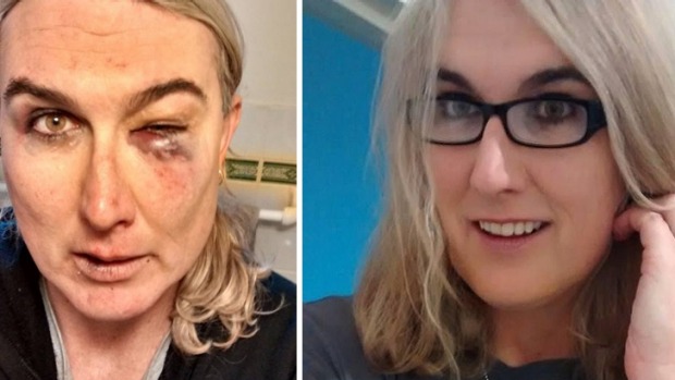 Stephanie McCarthy assault attack before and after