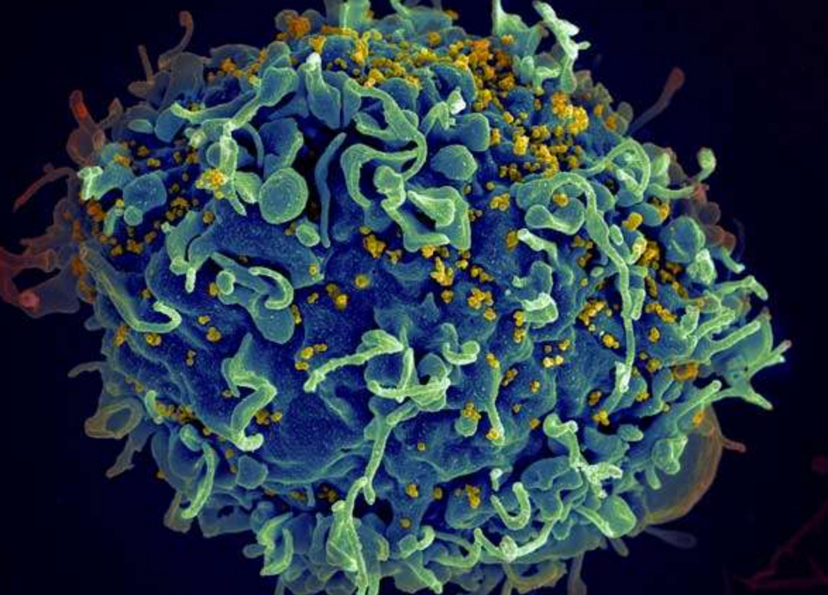 No HIV transmissions caused by partners after having sex 58,000 times