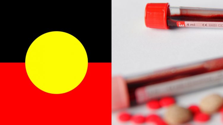 HIV aboriginal