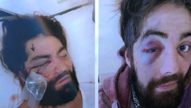 ‘Homophobic’ attack at Melbourne nightclub leaves man blind in one eye