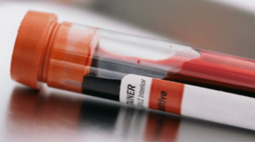 Blood hiv hep c disease test worker