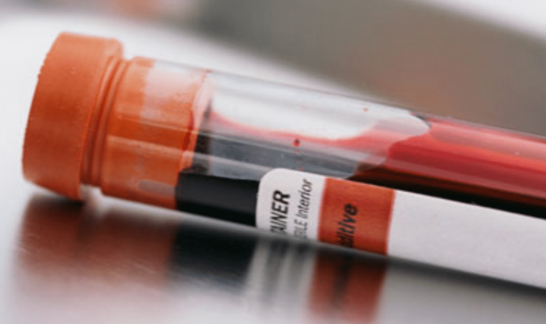 Blood hiv hep c disease test worker