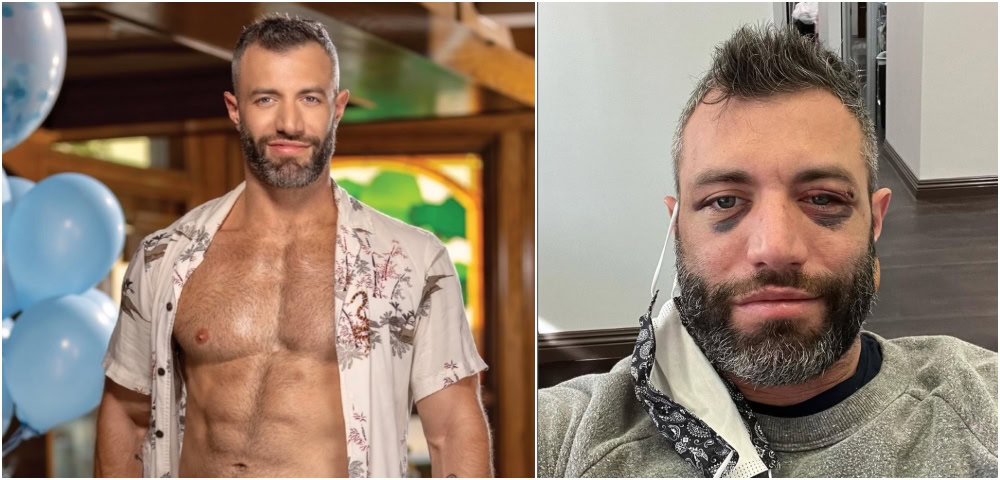 Gay Adult Entertainer Beaten and Mugged in Hollywood thumbnail