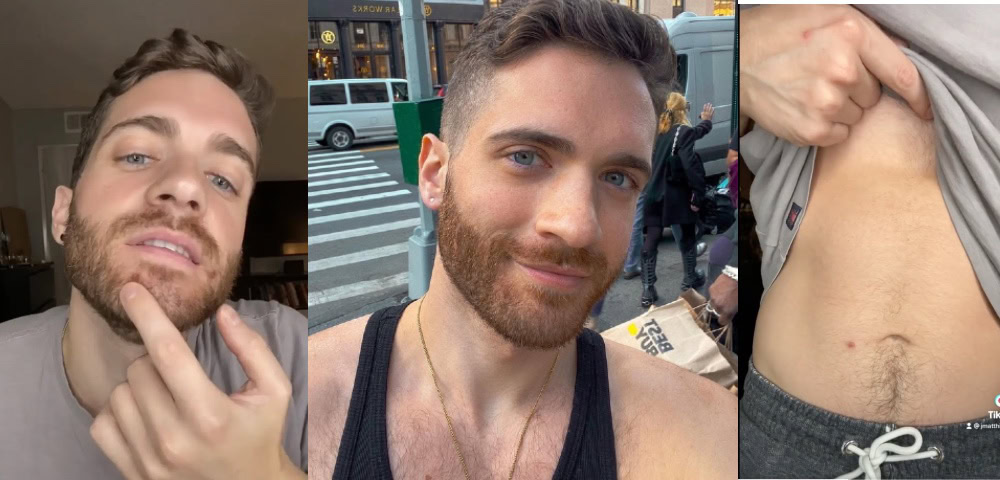 US Gay Man Shares His Monkeypox Diagnosis In Viral TikTok Video