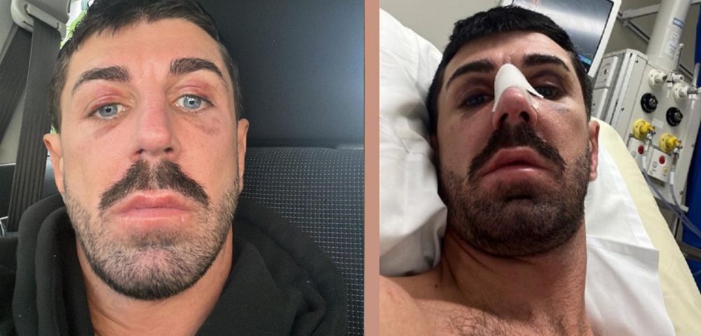 Gay Sydney Man Attacked On Oxford Street In Hate Crime