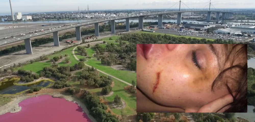 Fundraiser Set Up For Two Trans Women Attacked In Melbourne 