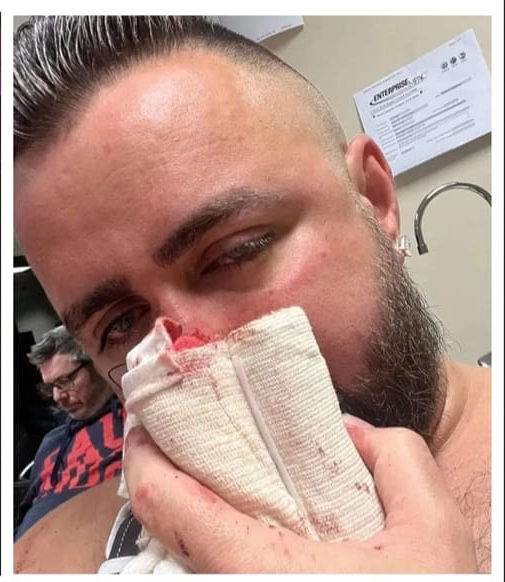 Adrian Lea (37) was left bleeding with a fractured nose after a vicious homophobic attack on him and his friend in Perth on April 9, 2023. 
