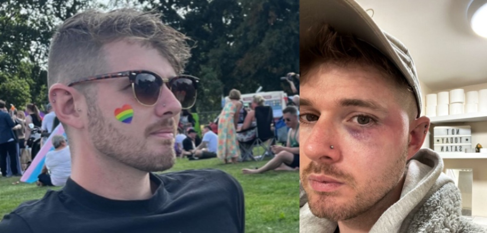 Gay Man Assaulted In Vicious Homophobic Attack In UK