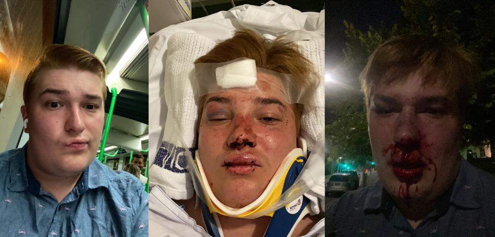 “The Worst Part Was The Shame”: What Happened After Jack Was Lured Into A Gay Hate Crime Ambush Off Grindr